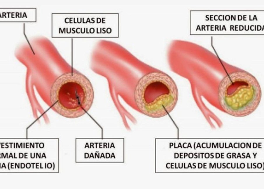 cortes transversales de arteria