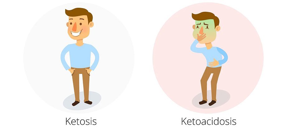 Diferencia entre cetosis y cetoacidosis