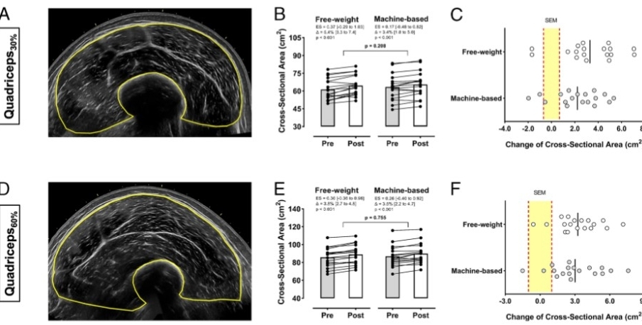 cuádriceps 30% y 60%