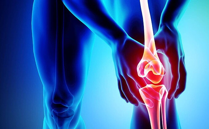 ¿Se puede hacer deporte con osteoartritis? El mejor ejercicio ¿Se puede hacer deporte con osteoartritis? El mejor ejercicio